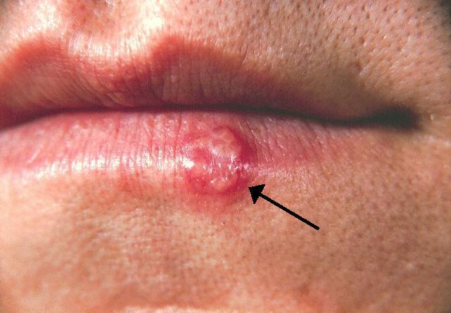 Antiviral research in the laboratory